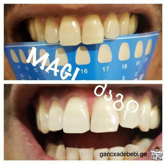 Tooth Whitening Products