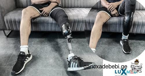 Luxmed Protez - Get prosthetic running leg in Georgia